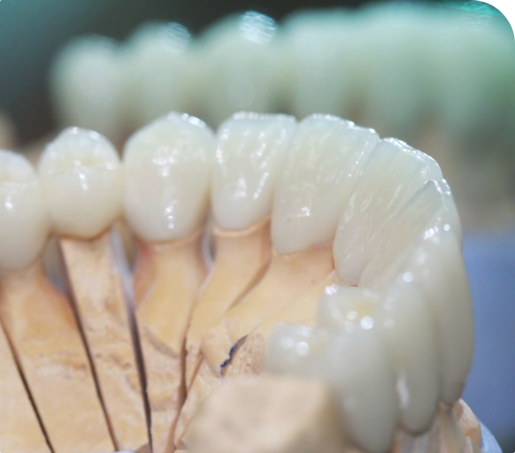 Одноэтапная имплантация зубов