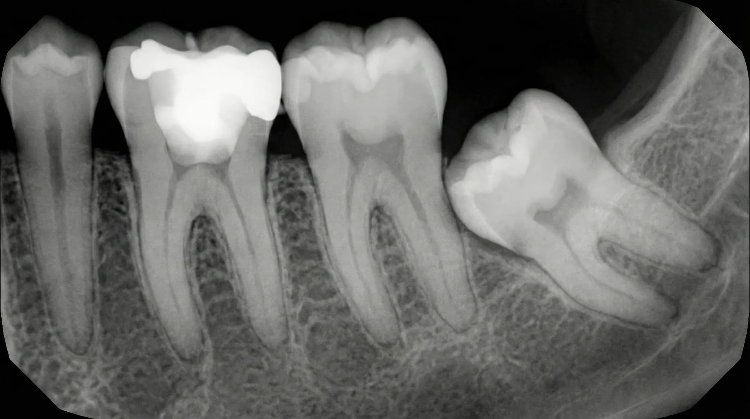 Прицельный снимок